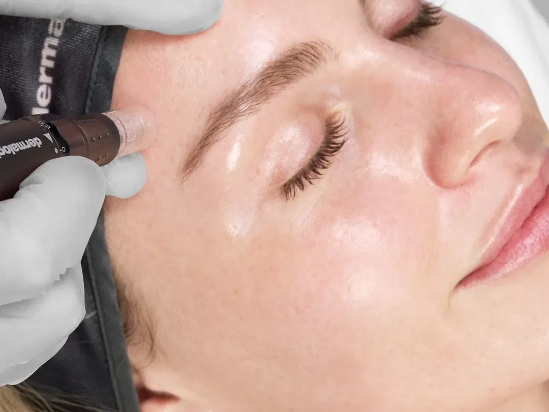 Gesichtsbehandlung im Kosmetikstudio Perfect Body, Frankfurt